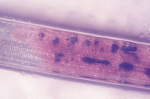 Ac�cula afectada por Dothistroma septospora